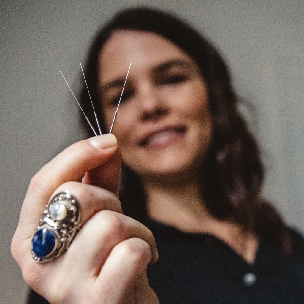 Zen Space Chiropractic | Cupping | Acupuncture | Dry Needling